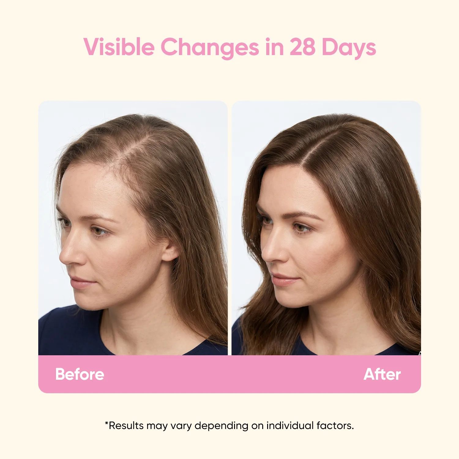Postnatal Hair Nutrition - Image 4